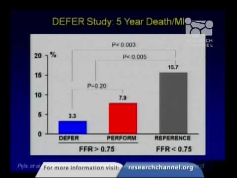 Who Needs a Coronary Artery Stent?