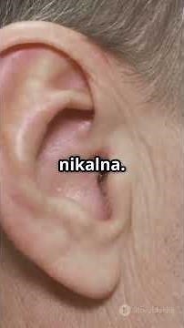 कहीं देर न हो जाए मास्टॉइडाइटिस के लक्षण और इलाज ( MASTOIDITIS TREATMENT) #doctor #earinfection