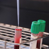 Video: Measuring Granulocyte and Monocyte Phagocytosis and Oxidative Burst Activity in Human Blood