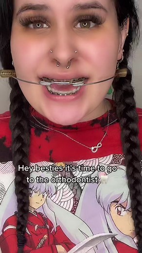 Getting Braces Off: My Orthodontist Visit Experience