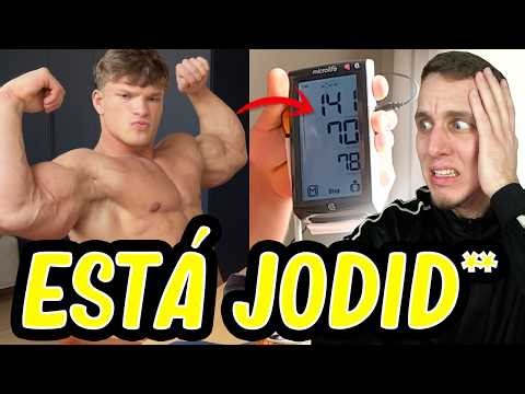 He won't make it to 30 if he keeps this up... *20-year-old bodybuilder*