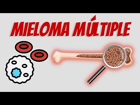 Mieloma Múltiple Explicado Claramente