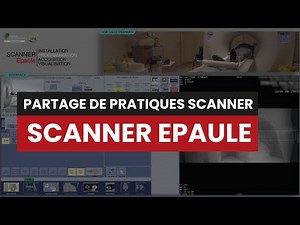 CT SCANNER EPAULE - Partage de pratique