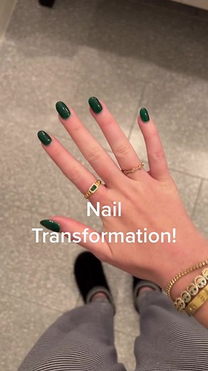 What should I do next?! #nailtransformation #nailart