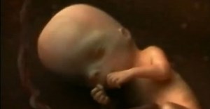 Développement du fœtus : le 3ème mois de grossesse