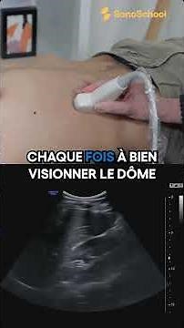 Échographie du foie : les 3 coupes sagittales essentielles – iSonic | SonoSchool