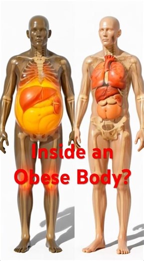 What Happens Inside an Obese Body? | 3D Medical Animation.