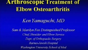 Arthroscopic Treatment of Elbow Osteoarthritis