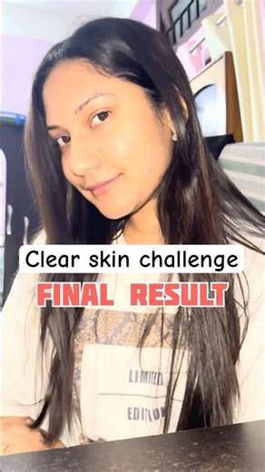 Final Day of my Clear Skin Challenge ❤️✨ #skincarechallenge #acneproneskin