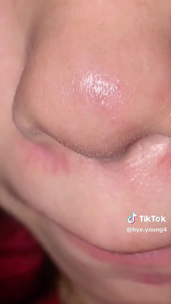 BHA Cleanser Review for Oily Skin Types