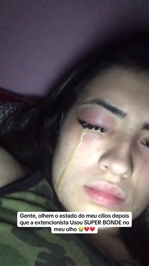 💔😭 #mulher #cilios #hospital #salaodebeleza #beleza