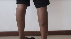 Ghana: Discrimination, Violence Against LGBT People