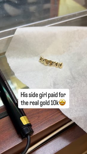 Wow 🤩 His side girl paid for the real gold 💯 | Real Mike Gold Teeth