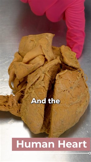 Institute of Human Anatomy on Instagram: "Inside a Real Human Heart: The 4-Chamber Powerhouse 🫀💪 Check out this real human heart! Let's break down its incredible anatomy and how it pumps blood through your entire body. The 4 Chambers 🔢 Your heart has 4 chambers: 2 atrial chambers (right & left atrium) 2 ventricular chambers (right & left ventricle) Right Side: Deoxygenated Blood 🔵 The right atrium gathers deoxygenated blood returning from body tissues → passes through the tricuspid valve → i