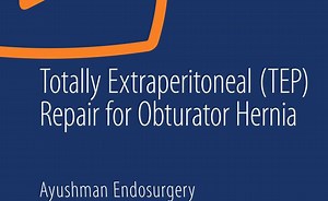 Totally Extraperitoneal (TEP) Repair for Obturator Hernia
