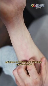 Apa yang Terjadi jika Kamu Digigit Semut Api? #SemutApi #Solenopsis #mitos #fakta #viral #shorts