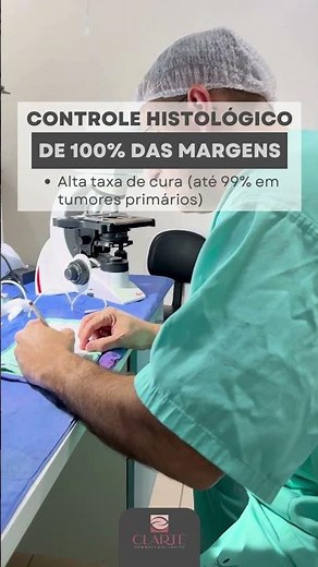 Cirurgia Micrográfica de Mohs.