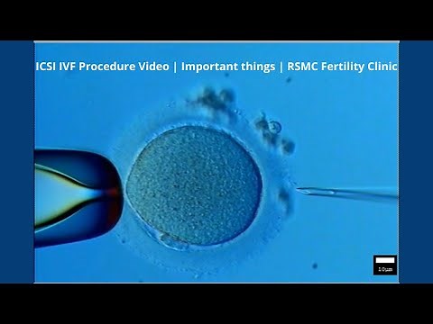 ICSI IVF Procedure Video | Important things | RSMC Fertility Clinic