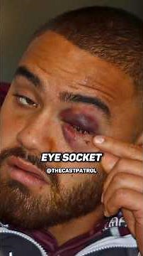 Dylan WALKER vs Curtis SCOTT Fight 🥊