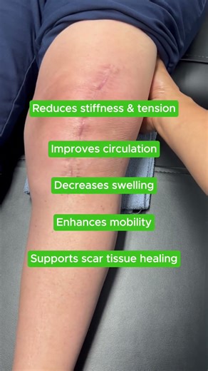 Here’s why soft tissue mobilization can make a big difference in how you heal 💆‍♀️