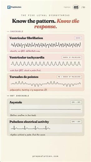 CCRN Exam Practice | Lethal Rhythms | Shock or Don't | PrepSolution