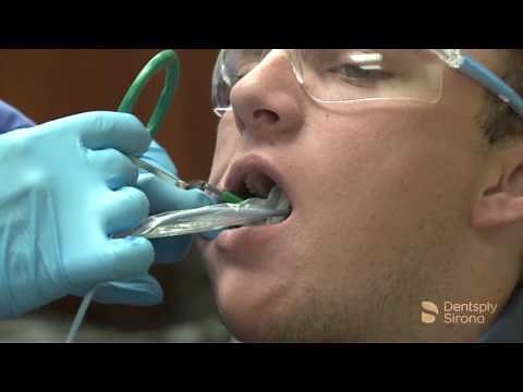 RINN XCP Short Arm Endodontic Placement | Dentsply Sirona