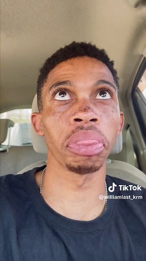 challenge gone wrong 🤦🏻‍♂️🥜 #williamlast_krm #motsetserepa