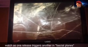 Core Connections 4 – The Dynamic Fascial System – Module 1 – with Steven Goldstein