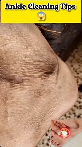 1.5M views · 7.1K reactions | ✅Ankle Cleaning Tips|| Feet Darkspots Remove Home Remedy #shorts #skincare #fbreelsfypシ゚viralfbreelsfypシ゚viral #fypviralfypviralシ #fbreels2025ツ #fbreelsfypシ゚viralシ #reelsviralシfb #reelsfbシ #beautywithsunanda #fbreelsfypシ゚ #fbreels #reelsfypシ | Beauty With Sunanda | Facebook