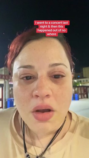 So about last night….. I survived my 4th anaphylactic shock in less than a year! Guess it’s not my time to go just yet 🤭 #anaphylaxis #allergy #hives #er #nurse #doctor #emt #concert #medical