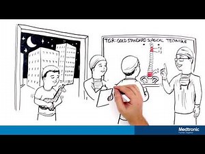 Early Onset Growing Rods Procedural Video