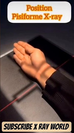 SCAPHOID AND PISIFORM BONE RADIOGRAPHY || scaphoid view and pisiform view x ray #scaphoid #pisiform