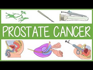Prostate Cancer Visually Explained