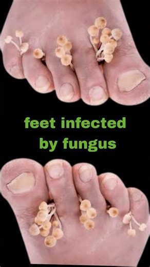 Discover the Natural Formula Gaining Worldwide Attention #kerassentials #kerassentialsreview