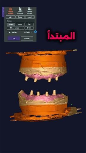 افضل طريقة لتشذيب الطبعة في ال exocad