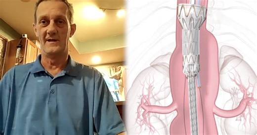 'I have a lot to live for': Buffalo's Mercy Hospital performs first TAMBE repair