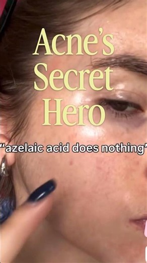 🎖️Azelaic Acid Benefits for Acne, Pigmentation & Redness