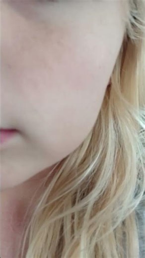 I have chubby cheeks