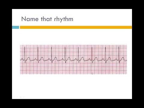 EKG Interpretation PPT pptx