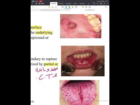 Oral pathology 1 lecture 2 (updated)