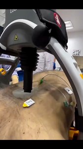 💥 Breaking Ribs During CPR 😵‍💫 Sometimes, when doing CPR or chest compressions, it’s possible to break a rib. Why does it happen? • When you do chest compressions, you need to push at least 2 inches (5 cm) deep. • Dahil malakas Ang pressure, minsan nababali ang ribs, lalo na kung matanda at may osteoporosis kasi fragile na ang chest bones nila. How often? • Studies show around 20–40% of patients na na-CPR, ay may rib fracture. Is it dangerous? • Yes, masakit at may possible complications siya