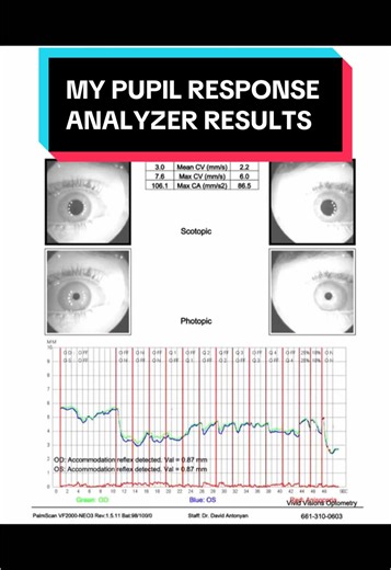 Innovative Pupil Response Analyzer at Vivid Visions