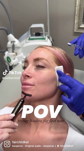 POV: Trying Sculptra for the first time! This is my first go with any facial filler other than in my lips so I was naturally a little nervous and SUPER cautious! The thing that made me fall in love with Scultra is that it is not your typical filler. It is a liquid that is injected into your skin but dissolves to then stimulate your body’s natural collagen production. It’s injected into targeted areas of your face, where it gradually helps to restore volume and firmness over time. It doesn’t prov