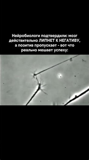 Нейробиологи подтвердили: мозг действительно ЛИПНЕТ К НЕГАТИВУ, а позитив пропускает: