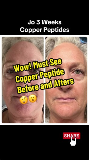 Copper Peptides: Transform Your Skin with Science