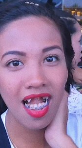 7.2K reactions · 207 shares |  CORRECTIVE DENTISTRY  Using ...