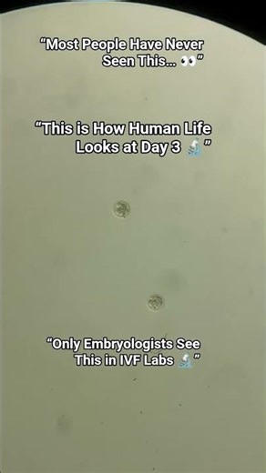 This is how a Day-3 embryo looks under the microscope, just 72 hours after fertilization in an IVF.