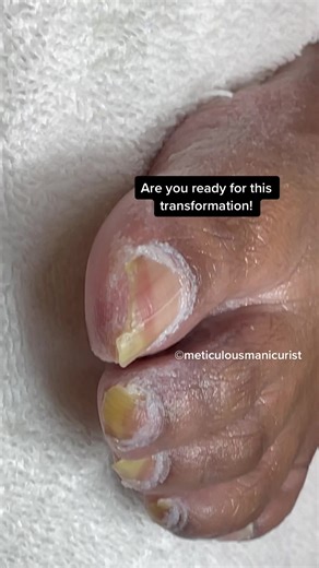 Pedicure and Nails Tutorials (@meticulousmanicurist)’s videos with original sound - Pedicure and Nails Tutorials