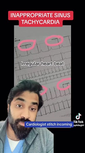 What is inappropriate sinus tachycardia? #sinustachycardia #inappropiatesinustachycardia #viralsyndrome #hearthealth #cardiology #medicine #doctor