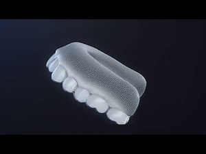 Thinking of Getting Invisalign? Here’s What You Should Know Before You Start!